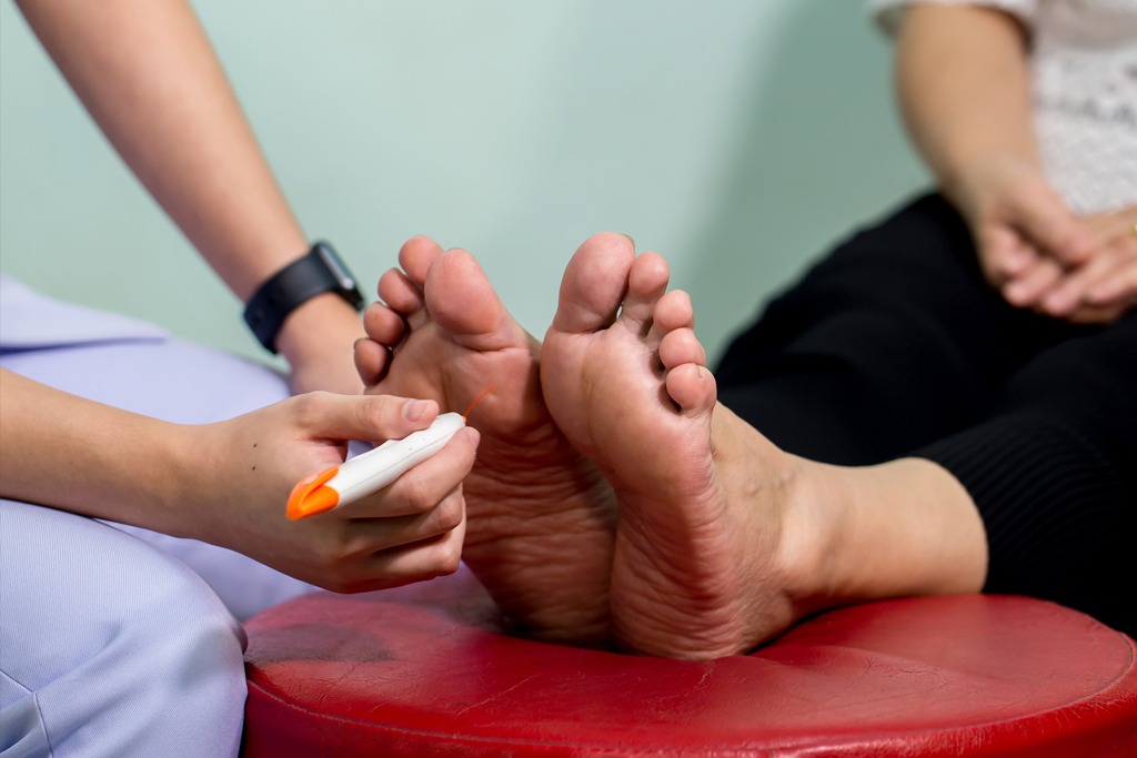 The doctor examines the nerve response with monofilament odiatrist treating feet during procedure. Doctor neurologist examining female patient .
