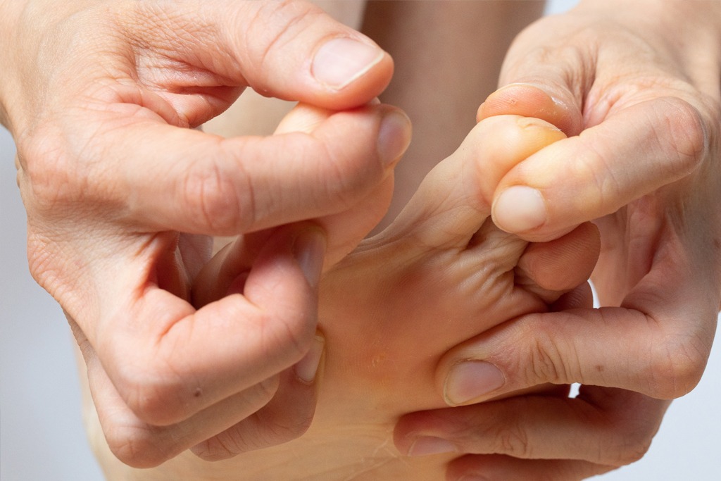 Inspection of the toes with the hands to detect the presence of calluses, warts or athlete's foot